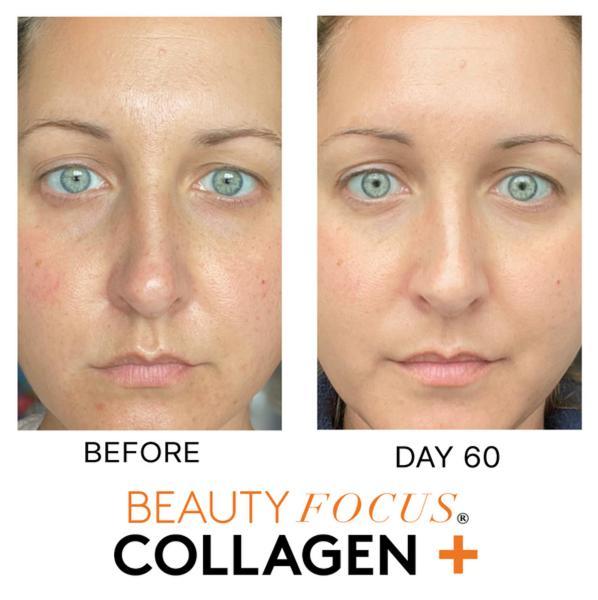 Unlock Youthful Skin: Collagen Skin Elasticity Treatment Tips